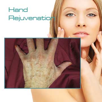 Hand Rejuvenation Skin Rejuvenation and Skin Care Applications and Skin Renewal Detail Information