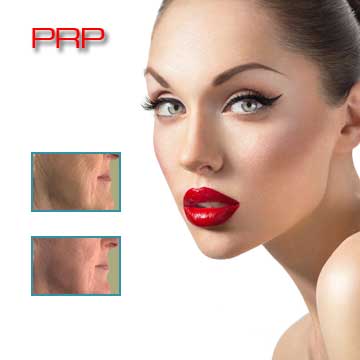 Antiaging Skin Rejuvenation with PRP Detail Information