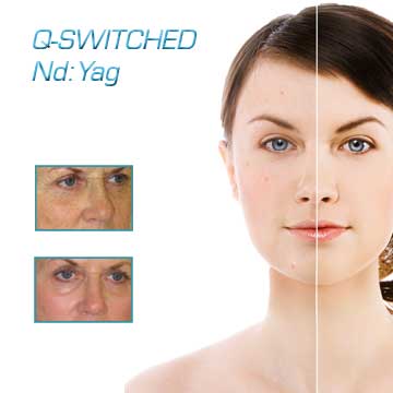 Q-Switched ND Yag Laser Q-Switched Laser Applications Antiaging Detail Information