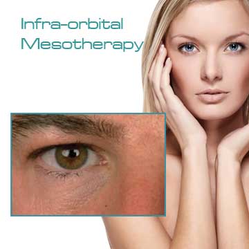 Antiaging Skin Renewal Infra-orbital Mesotherapy Light Eyes Ultra Detail Information
