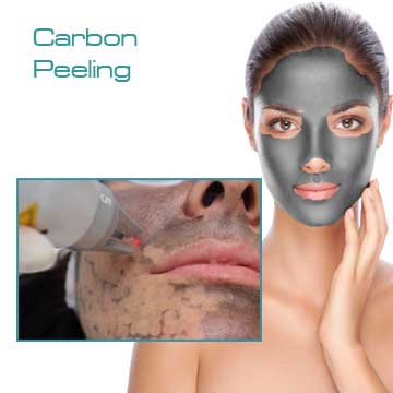 Skin Renewal and Skin Care Q-Switched Nd:Yag Laser Carbon Peeling Detail Information