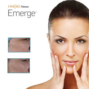 Antiaging Technology EMERGE LASER The only FDA-approved laser which may be applied to eyelid and around eye