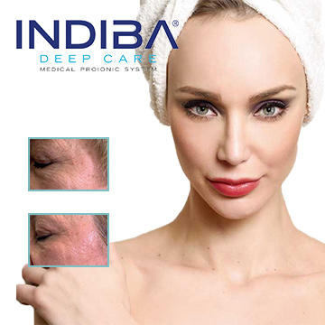 INDIBA® Deep Care medikal estetik hakkında detay bilgi