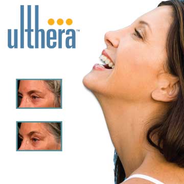 Antiaging Technology Ultherapy Face Lift in a Single Session without Operation