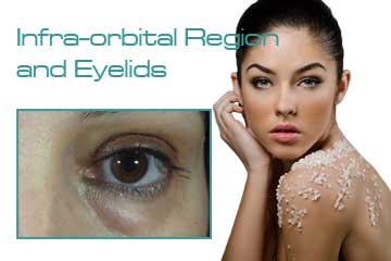 Anti-aging Treatments for Infra-orbital Region and Eyelids Detail Information