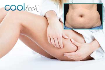 Local Slimming - Body Shaping - Weight Loss Cellulitis Cold Lypolysis 