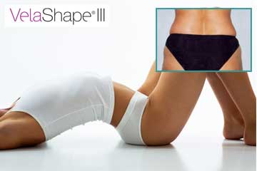 Local Slimming-Body Shaping-Weight Loss Cellulitis Velashape