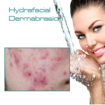 Skin Renewal Hydrafacial Dermabrasion Detail Information